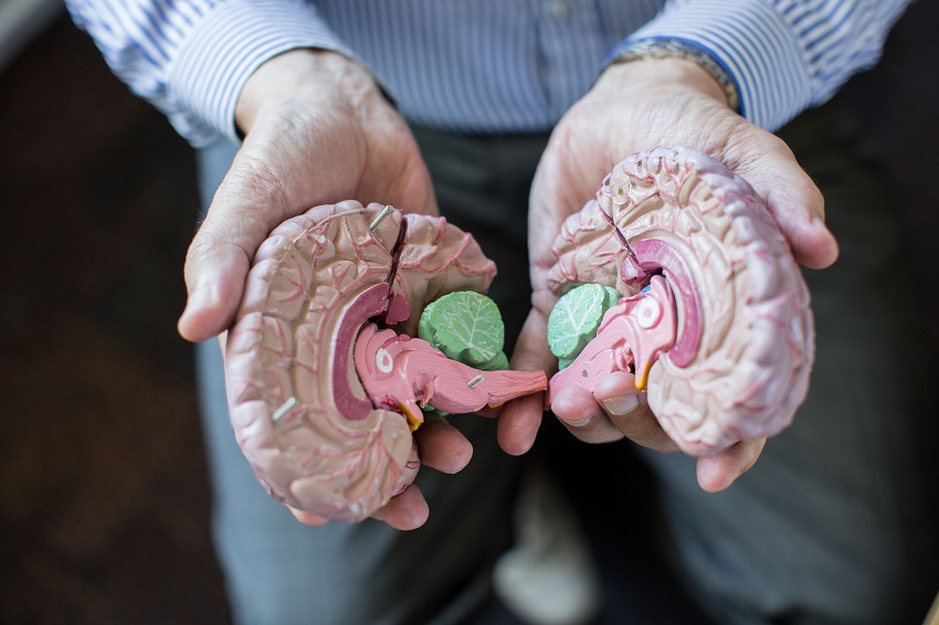 A model of a brain