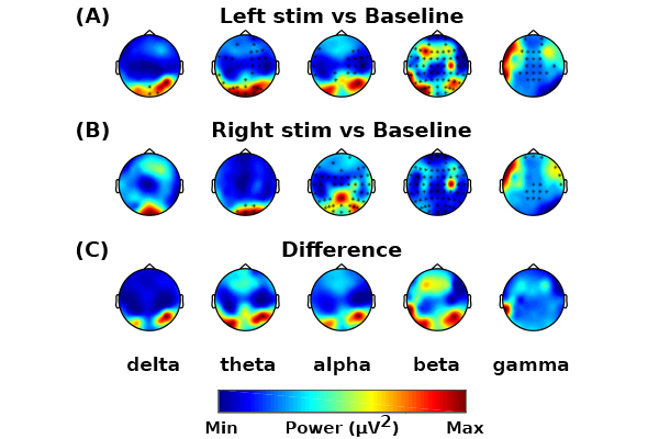 Left stim and baseline