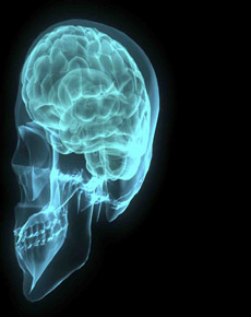 36,000 new brain injuries in NZ each year, incidence at “epidemic proportions”
